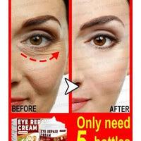 Eye Repair Cream (Pack of 2)